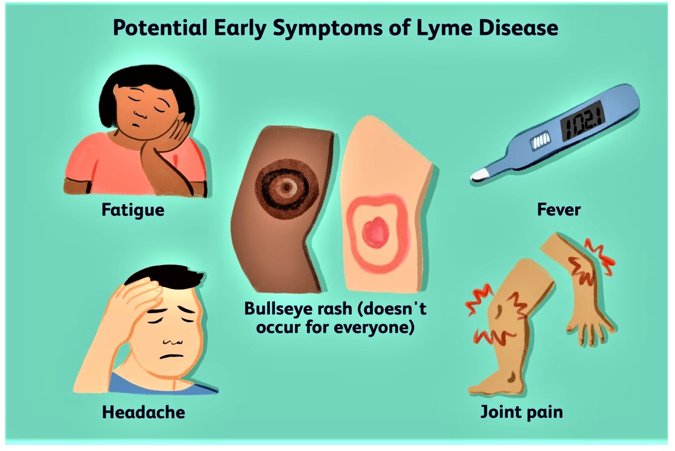 Study reveals over 14 of world population has Lyme disease Hayti